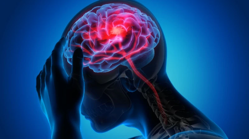 Understanding Focal Neurological Signs
